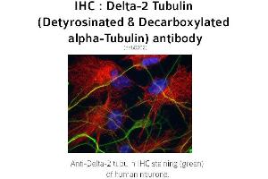 Image no. 2 for anti-Tubulin delta 2 (C-Term) antibody (ABIN489937) (Tubulin delta 2 (C-Term) antibody)