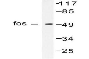 Image no. 1 for anti-c-Fos (c-Fos) antibody (ABIN265423) (c-FOS antibody)