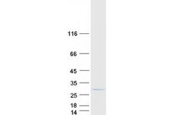 COMMD5 Protein (Transcript Variant 3) (Myc-DYKDDDDK Tag)