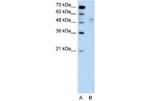 WWP2 antibody used at 1 ug/ml to detect target protein. (WWP2 antibody  (Middle Region))