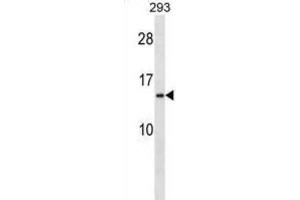 Western Blotting (WB) image for anti-Ribosomal Protein S20 (RPS20) antibody (ABIN2998579) (RPS20 antibody)