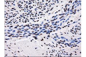 Immunohistochemical staining of paraffin-embedded endometrium tissue using anti-SORDmouse monoclonal antibody. (SORD antibody)