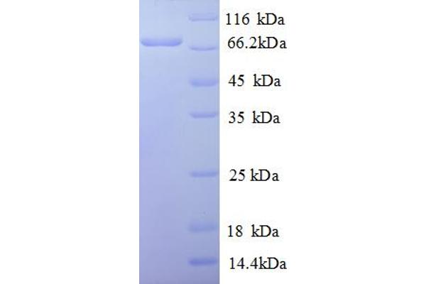 c-Rel Protein (AA 3-616, partial) (His tag)