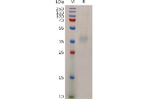 Human L1 Protein, His Tag on SDS-PAGE under reducing condition. (NPC1L1 Protein (AA 22-284) (His tag))