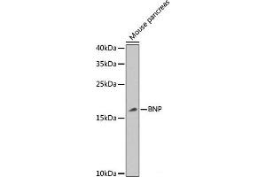 Western blot analysis of extracts of Mouse pancreas using BNP Polyclonal Antibody at dilution of 1:1000. (BNP antibody)