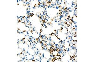 Immunohistochemistry (Paraffin-embedded Sections) (IHC (p)) image for anti-Lymphocyte Antigen 6 Complex, Locus G (Ly6g) antibody (ABIN7074524)