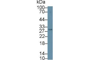 Western blot analysis of Mouse Serum, using Mouse CLEC4L Antibody (2 µg/ml) and HRP-conjugated Goat Anti-Rabbit antibody ( (DC-SIGN/CD209 antibody  (AA 115-238))