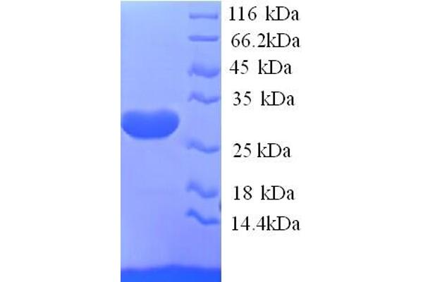 KCND2 Protein (AA 406-630, Cytoplasmic Domain, Cytosolic) (His tag)