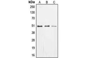 Western blot analysis of EGR1 expression in MCF7 (A), SHSY5Y (B), PC12 (C) whole cell lysates. (EGR1 + EGR2 (C-Term) antibody)