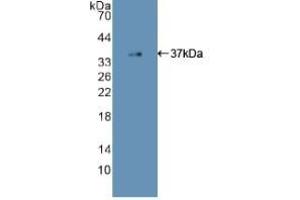 Detection of Recombinant EGFR2, Human using Polyclonal Antibody to Epidermal Growth Factor Receptor (EGFR) (EGFR antibody  (AA 713-984))