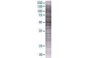 CYP4F22 transfected lysate. (FLJ39501 293T Cell Transient Overexpression Lysate(Denatured))