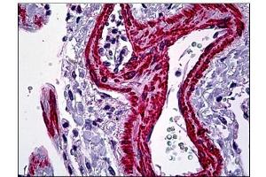 Human Lung, Vessels: Formalin-Fixed, Paraffin-Embedded (FFPE) (Smooth Muscle Actin antibody  (N-Term))