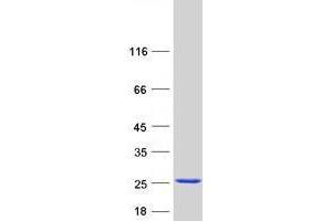 Validation with Western Blot (UBE2D3 Protein (Transcript Variant 9) (Myc-DYKDDDDK Tag))