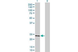 Western Blot analysis of TIMP2 expression in transfected 293T cell line by TIMP2 MaxPab polyclonal antibody. (TIMP2 antibody  (AA 1-220))