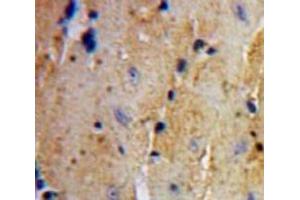 Used in DAB staining on fromalin fixed paraffin-embedded Heart tissue (Ubiquitin Hydrolase L3 (AA 2-230) antibody)