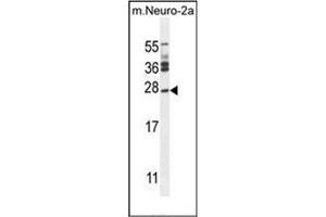 JOSD2 antibody  (N-Term)