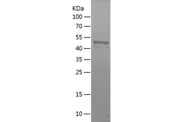 FOXP3 Protein (AA 2-249) (His-IF2DI Tag)