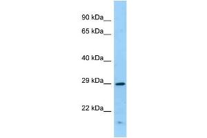 Western Blotting (WB) image for anti-Interferon gamma Receptor 1 (IFNGR1) (C-Term) antibody (ABIN2789606) (IFNGR1 antibody  (C-Term))