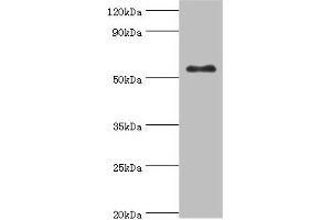 Western blot All lanes: Glucokinase antibody at 8 μg/mL + HepG2 whole cell lysate Secondary Goat polyclonal to rabbit IgG at 1/10000 dilution Predicted band size: 52 kDa Observed band size: 52 kDa (GCK antibody  (AA 1-300))