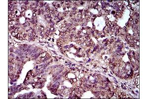 Immunohistochemistry (IHC) image for anti-Interleukin 2 Receptor, alpha (IL2RA) (AA 34-139) antibody (ABIN1724861)