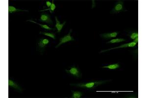 Immunofluorescence of purified MaxPab antibody to COQ3 on HeLa cell. (COQ3 antibody  (AA 1-369))