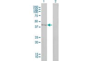 Western Blot analysis of DNMT2 expression in transfected 293T cell line by DNMT2 monoclonal antibody (M01), clone 1E12. (Dnmt2 antibody  (AA 1-391))