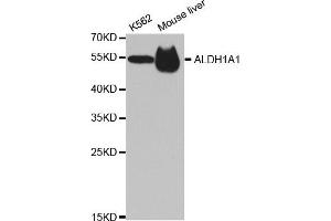 Western blot analysis of extracts of K562 and mouse liver cell lines, using ALDH1A1 antibody. (ALDH1A1 antibody)