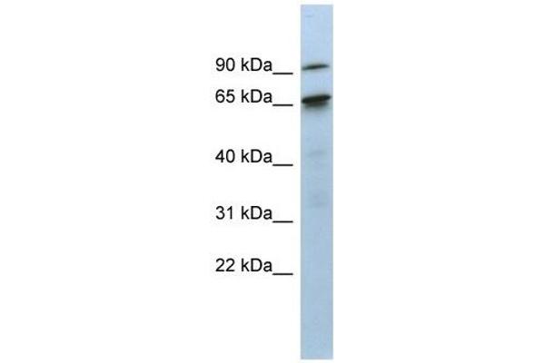 CTIF/KIAA0427 antibody  (N-Term)