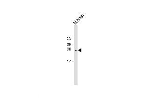Mouse brain lysates probed with LXN (199CT6. (Latexin antibody)
