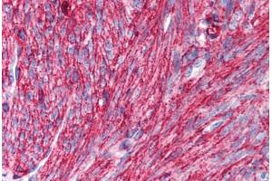 Human Uterus, Smooth Muscle (formalin-fixed, paraffin-embedded) stained with CD44 antibody ABIN239810 at 10 ug/ml followed by biotinylated anti-mouse IgG secondary antibody ABIN481714, alkaline phosphatase-streptavidin and chromogen. (CD44 antibody)