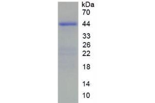 HIST2H2AC Protein