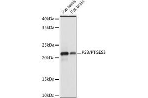 Western blot analysis of extracts of various cell lines, using P23/PTGES3 Rabbit mAb (ABIN1679503, ABIN3019390, ABIN3019391 and ABIN7101767) at 1:1000 dilution. (PTGES3 antibody)