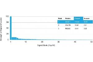 Protein Array (PAr) image for anti-Ubiquitin Carboxyl-terminal Esterase L1 (Ubiquitin Thiolesterase) (UCHL1) antibody (ABIN6940856)