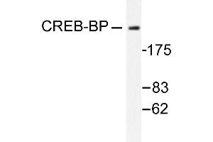 Image no. 1 for anti-CREB Binding Protein (CREBBP) antibody (ABIN265372) (CBP antibody)