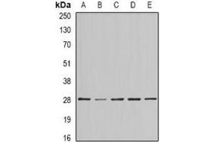 Western blot analysis of BAP29 expression in SKOV3 (A), MCF7 (B), mouse testis (C), mouse brain (D), rat heart (E) whole cell lysates. (BCAP29 antibody)