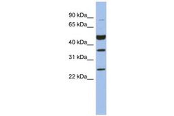 MAGEB3 antibody  (AA 35-84)