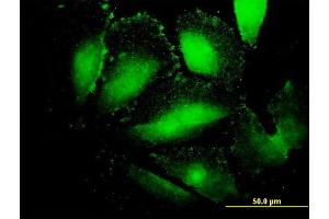 Immunofluorescence of monoclonal antibody to AFP on HepG2 cell. (alpha Fetoprotein antibody  (AA 500-609))