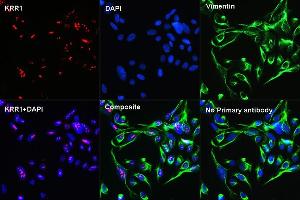 Confocal Immunofluorescent analysis of U2OS cells using KRR1 Rabbit pAb  at dilution of 1:100 (40x lens)(red). (KRR1 antibody  (AA 1-381))