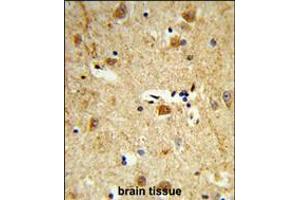 Formalin-fixed and paraffin-embedded human brain tissue reacted with DOLK Antibody , which was peroxidase-conjugated to the secondary antibody, followed by DAB staining. (Dolichol Kinase antibody  (AA 312-339))