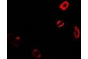 Immunofluorescent analysis of GNT1 staining in MCF7 cells. (Ugt1 antibody)
