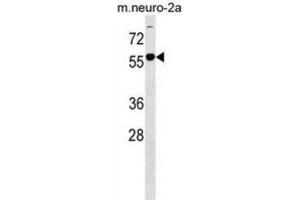 Western Blotting (WB) image for anti-beta-1,4-N-Acetyl-Galactosaminyl Transferase 1 (B4GALNT1) antibody (ABIN3000154) (B4GALNT1 antibody)