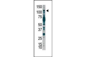 Image no. 1 for anti-Phosphoinositide-3-Kinase, Catalytic, beta Polypeptide (PIK3CB) (C-Term) antibody (ABIN360447) (PIK3CB antibody  (C-Term))