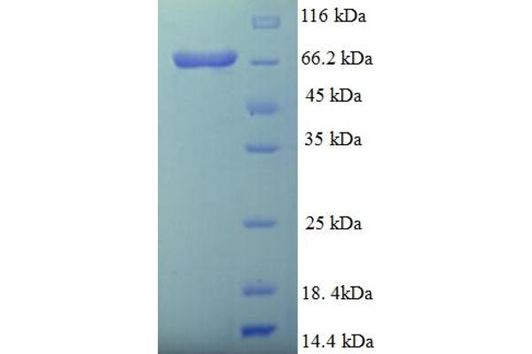 D2HGDH Protein (AA 56-533) (His-SUMO Tag)