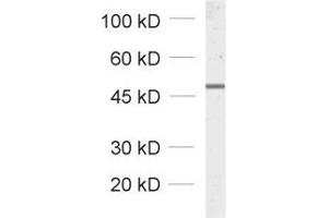 dilution: 1 : 1000, sample: total cell lysate from fibroblasts transfected with a GFP fusion construct (GFP antibody)