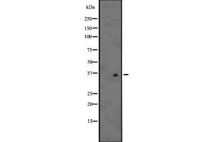 Western blot analysis of PDLIM1 using K562 whole cell lysates (PDLIM1 antibody  (Internal Region))