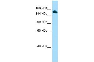 Host:  Rabbit  Target Name:  Setd5  Sample Type:  Mouse Stomach lysates  Antibody Dilution:  1. (SETD5 antibody  (C-Term))