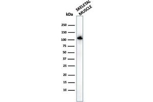 Western Blot of human Skeletal muscle tissue lysates using Sarcomeric Actinin Alpha 2 Mouse Monoclonal Antibody (ACTN2/3294). (ACTN2 antibody  (AA 557-692))