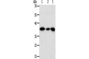 Western Blotting (WB) image for anti-Aldo-Keto Reductase Family 1, Member A1 (Aldehyde Reductase) (AKR1A1) antibody (ABIN2426543) (AKR1A1 antibody)