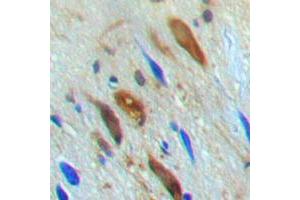 Immunohistochemical analysis of SMAD3 (pT179) staining in human brain formalin fixed paraffin embedded tissue section. (SMAD3 antibody  (pSer179))