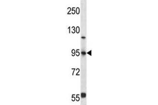 FOXP4 antibody  (AA 522-550)